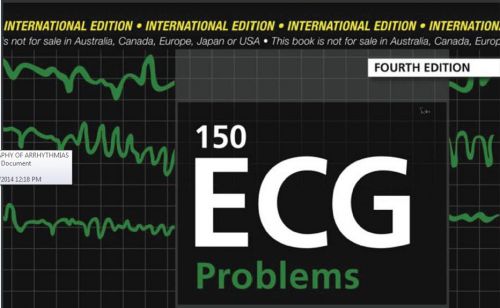 Understanding, easy analyzing  ECG e books