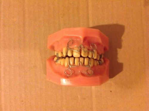 Orthodontic Dental Teeth With Braces #2