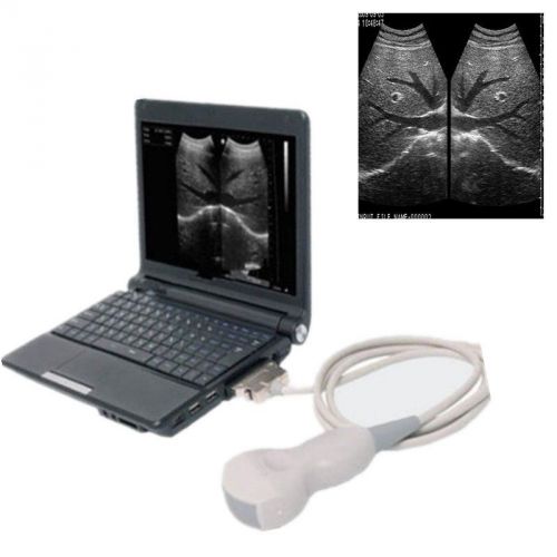 Hot medical ultrasound scanner laptop ultrasound scanner + convex probe for sale