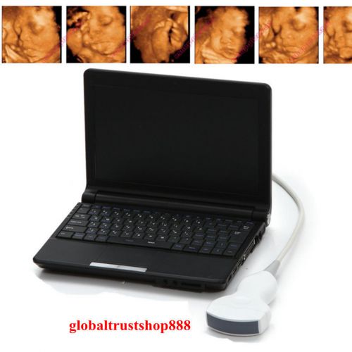 +3D Kit Portable Laptop Ultrasound Scanner Machine System 3.5MHz Convex Probe CE