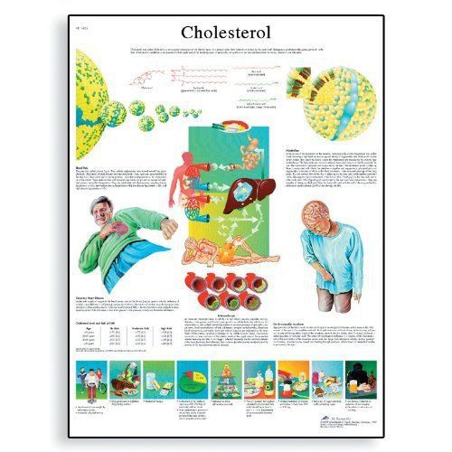 3b scientific vr1452l glossy laminated paper cholesterol anatomical chart  poste for sale