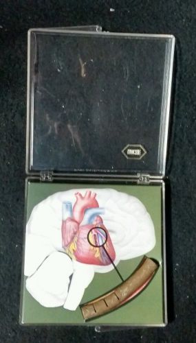 Vintage Antique Human Heart with Arteries Anatomical Model Atherosclerosis