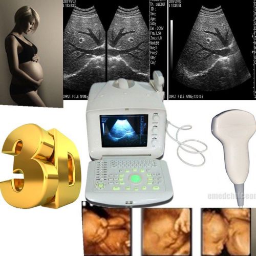 2015 new ultrasound scanner machine+ convex+external 3d workstation software kit for sale