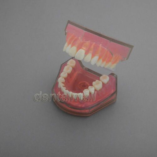 Dentalmall Dental Model #4004 01 - Standard Model with Removable Teeth
