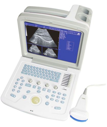Hot, B-Ultrasound Diagnostic Scanner machine+ 3.5MHZ convex probe,CE,CMS600B-3