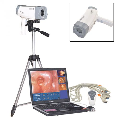 Digital electronic colposcope sony camera 800,000 pixels 1/4&#034;optical zoom lends for sale