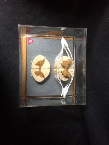 Somso bs32-37 spinal cord with nerve branches anatomical model (bs 32-37) for sale