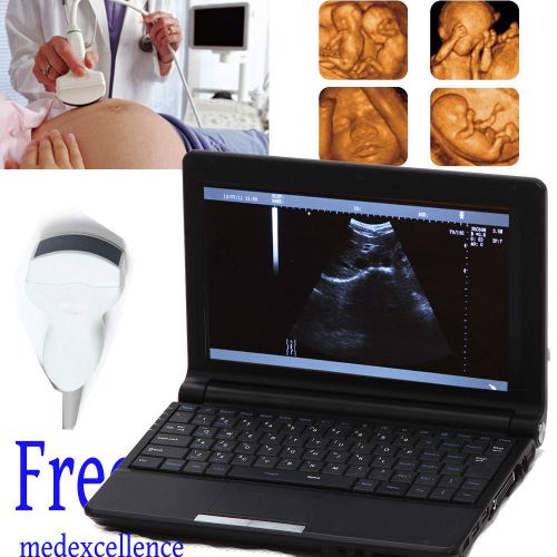 CE 10.1&#034; Full Digital Laptop Notebook Ultrasound Scanner Convex Probe + Free 3D
