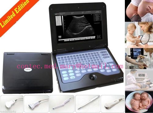 New Digital Portable Laptop Ultrasound Scanner Machine with Convex Probe,popular
