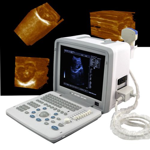 New Full Digital Portable Ultrasound Scanner Machine with 3.5Mhz Convex Probe 3D