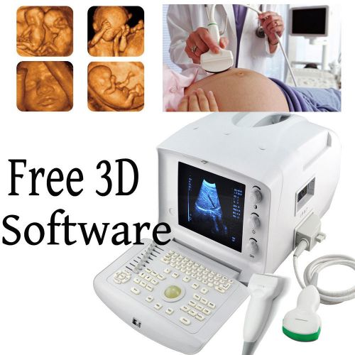 3d portable ultrasound scanner machine system convex+linear usb fda ce for sale