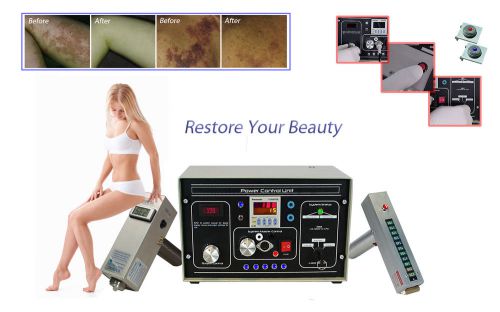 Sdpl dlx permanent birth mark, port wine stain, &amp; rosacea removal machine for sale