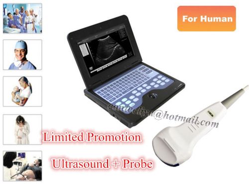 Portable Laptop New B-Ultrasound Diagnostic System+3.5mhz Convex Probe,10.1&#034; LCD