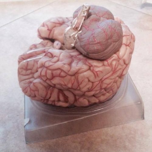 SOMSO Brain Model with Arteries BS 23 Anatomical Model