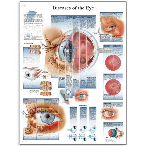 3b scientific vr1231uu glossy paper diseases of the eye anatomical chart  poster for sale