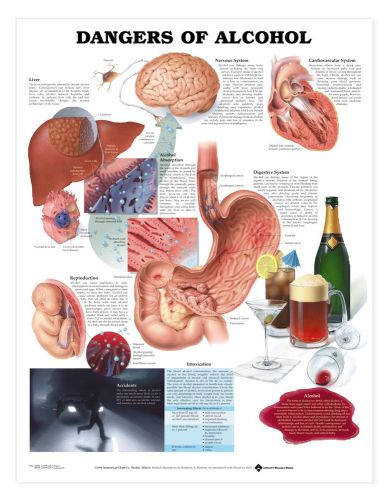 DANGERS OF ALCOHOL, LAMINATED ANATOMICAL CHART, 20 X 26