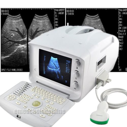 New 3d portable ultrasound scanner machine 2.5 3.0 3.5 4.0 mhz convex probe for sale