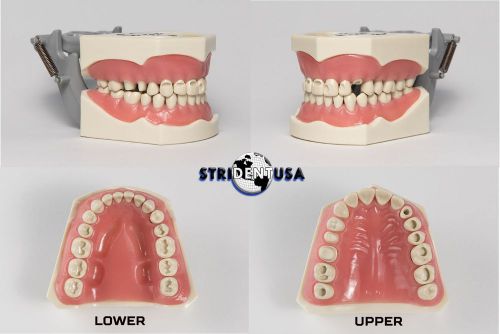 DENTAL TYPODONT MODEL 860 PREP TEETH MODEL FITS COLUMBIA BRAND REMOVABLE  TEETH