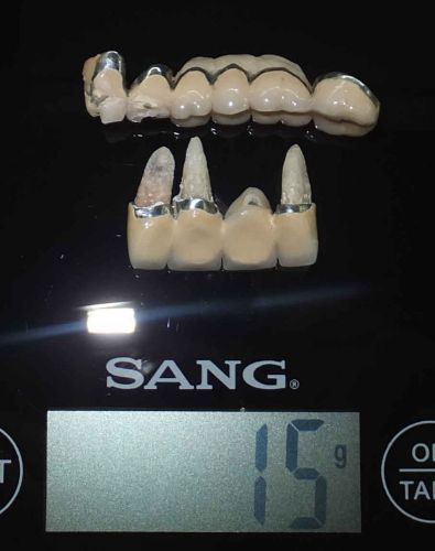 Dental scrap 15 grams. Cleaned and Desinfected.