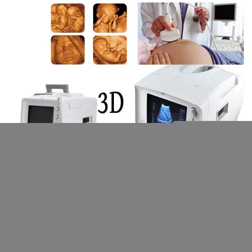 3d portable digital ultrasound machine/scanner convex +3d workstation + trolly for sale