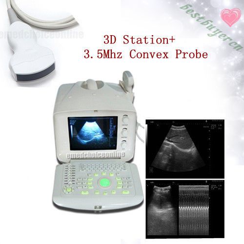 New ultrasound scanner rus-6000a convex probe 3.5mhz3d station usb warranty* for sale