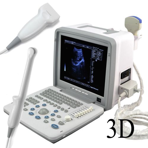 CE Full Digital Portable Ultrasound Scanner Convex Linear Trans-vaginal Probe 3D