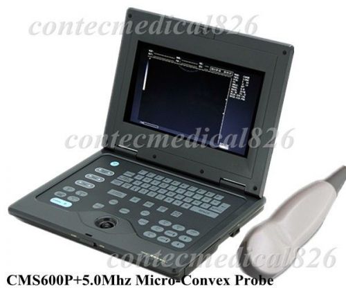 CE Notebook Digital Portable  Ultrasound scanner CMS600P+5.0Mhz Micro-Convex