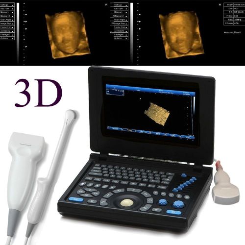 3D PC Full Digital Laptop Ultrasound Scanner + Convex + Linear + Trans-Vaginal