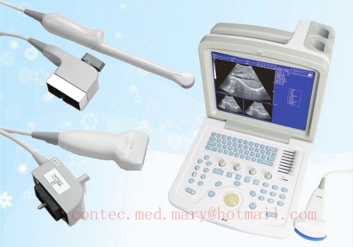 CE,Digital Portable Ultrasound Scanner Machine with three Free probes,Big Sale