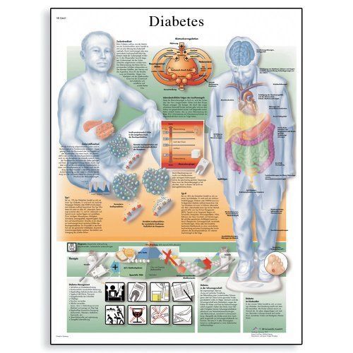 3B Scientific VR1441L Glossy Laminated Paper Diabetes Mellitus Anatomical Chart