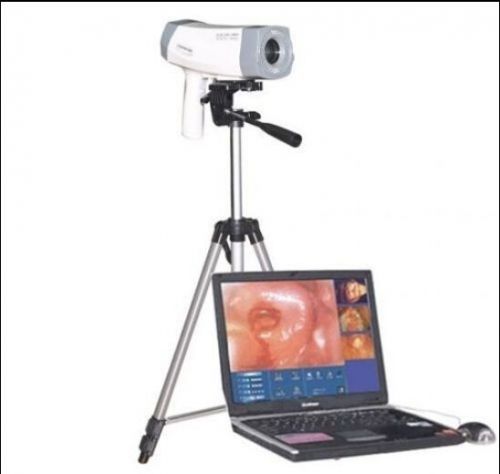 Ca -sale!!!digital video electronic colposcope+software sony 800000 pixel -ups for sale