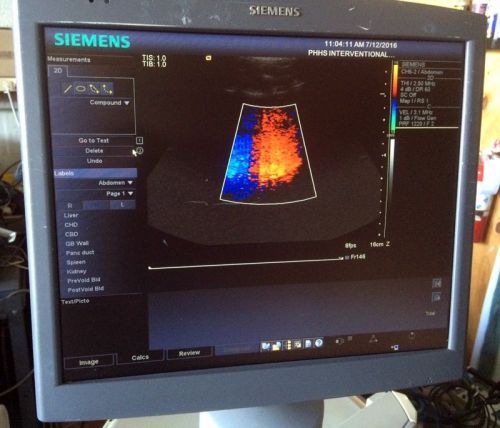 Siemens Acuson Antares Color Doppler Ultrasound Flat Screen with 3 Transducers