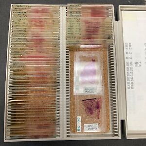 Vintage Medical Human Anatomy Microscope Slides Histology Pathology Bones/Joints