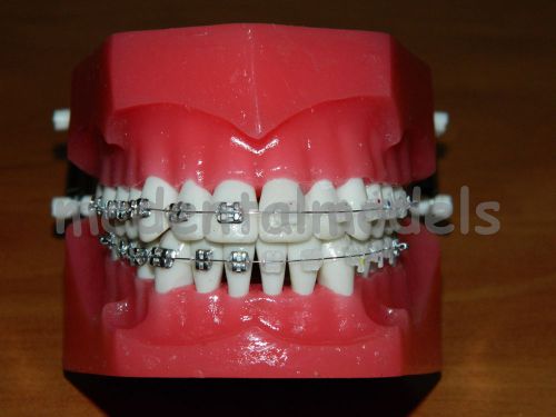 ORTHODONTIC ADULT BRACES TYPODONT DEMOSTRATION MODEL DENTOFORM TEETH TOOTH STUDY