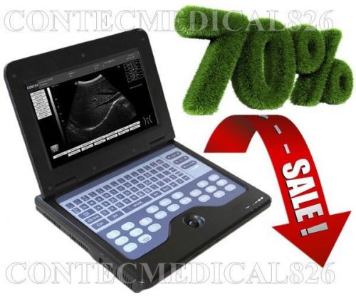 NEW {CMS600P2} Digital Notebook Ultrasound Scanner with 3.5Mhz Convex Probe