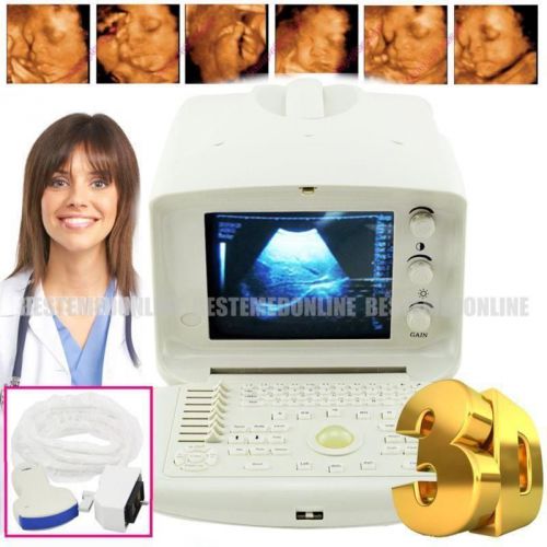 Brand hot portable ultrasound scanner machine system convex probe +external 3d for sale
