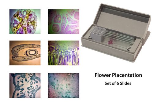Microscopy Prepared Slides: Flower Placentation - Set of 6