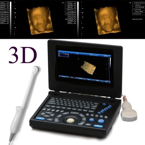 3d pc lcd full digital laptop ultrasound scanner convex trans-vaginal 2 probes for sale