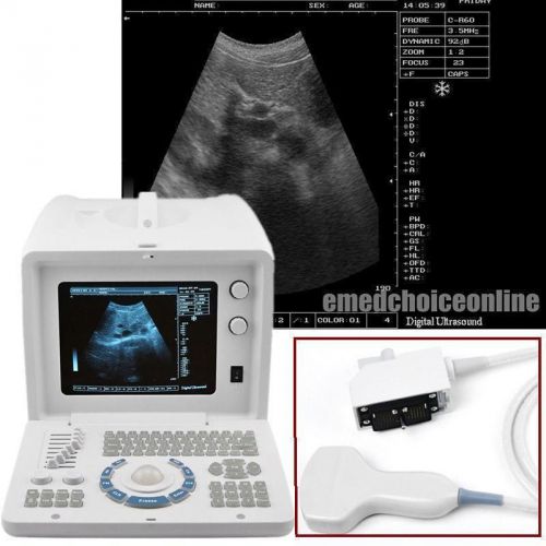 Digital ultrasound scanner machine portable -3.5 mhz convex probe-ext 3d bid bid for sale