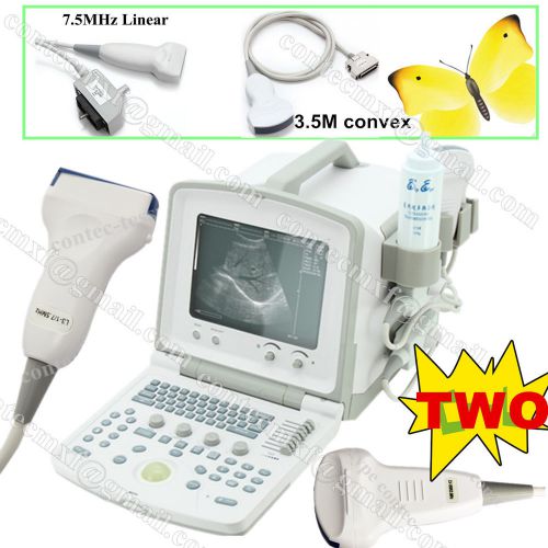 Cms600b2 portable ultrasound scanner diagnostic machine+7.5m linear probe+convex for sale