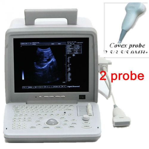 12 inch LCD Full Digital Portable Ultrasound Scanner with convex &amp; linear probe