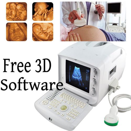 3D NEW Portable Ultrasound Scanner machine system CONVEX+ FREE 3D WORKSTATION