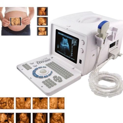 Digital ultrasound machine scanner system convex linear probe+3d fda  ce topsell for sale