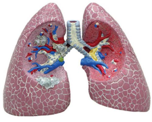 NEW Anatomical Human Diseased Lung Model WOW!
