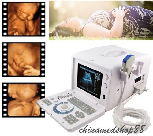 Usb portable full digital 10-inch ultrasound scanner with 3.5mh convex probe for sale