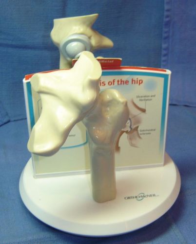 Ortho-Mcneil Hip Replacement Model Lonsys Medical Display Osteoarthritis