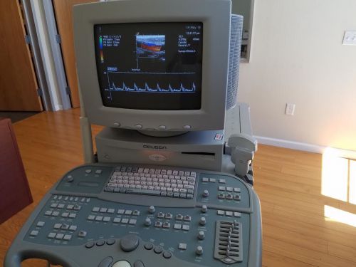 Siemens seqouia 512  abdominal ,ob,gyn  ,vascular color doppler  ultrasound for sale