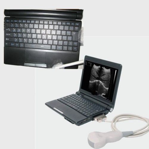 Sale full digital portable notebook laptop ultrasound scanner system best price for sale