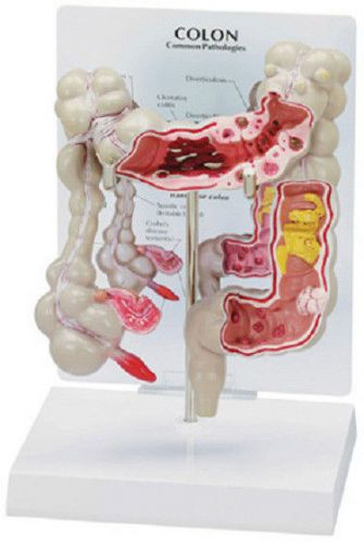NEW Anatomical Colon Cancer Large Intestine Model