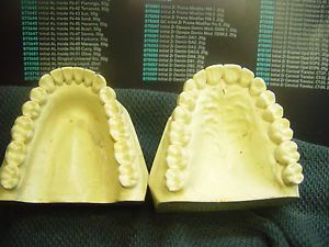 dental lab study / carving models